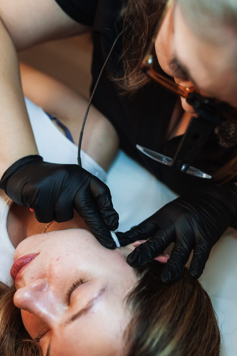 Andreea Mazilu - Ședințe Electroliză Electroepilare București