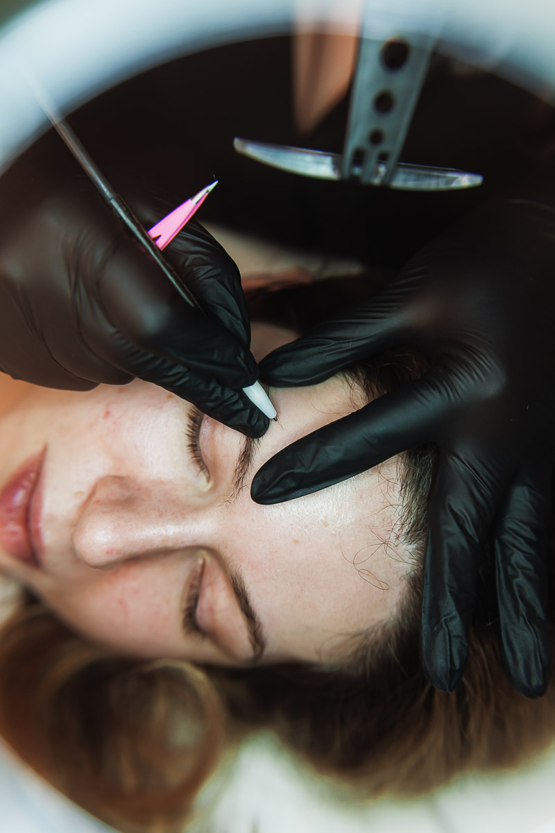 Andreea Mazilu - Ședințe Electroliză Electroepilare București